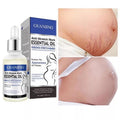Guanjing Anti Stretch Marks Serum